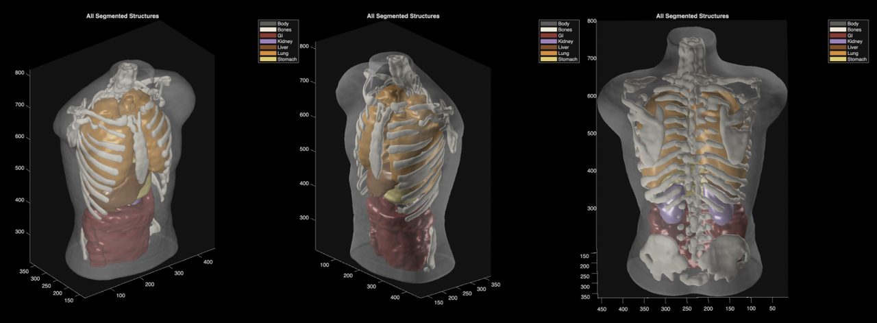 Midjourney plans full-body ultrasonic scanner for faster medical imaging Midjourney plans full-body ultrasonic scanner for faster medical imaging